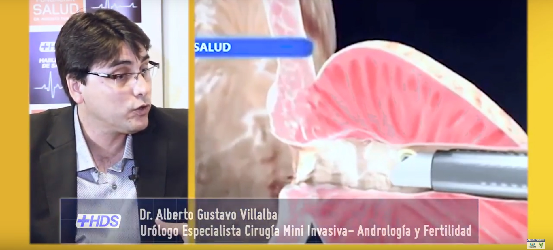 Hablemos de Salud Uruguay: Dr Alberto Villalba. Especialista en Cirugia Mini Invasiva de Prostata